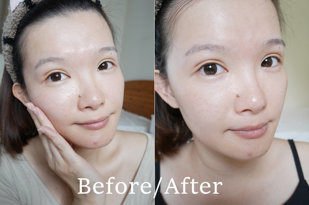 蘭蔻LANCOME 超進化肌因活性安瓶 小黑安瓶