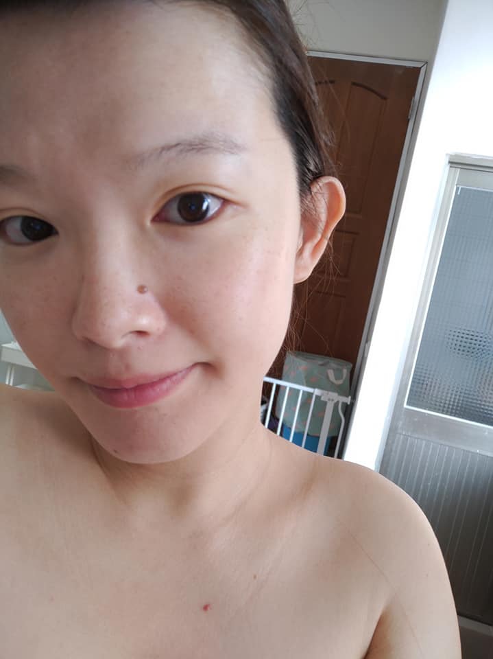 板橋清粉刺 做臉 江子翠站 台北做臉推薦.jpg