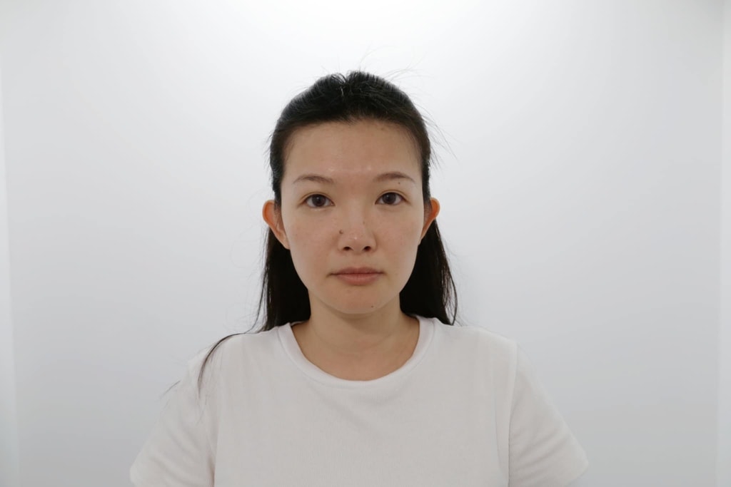 媚必提 佳思優醫美.jpg
