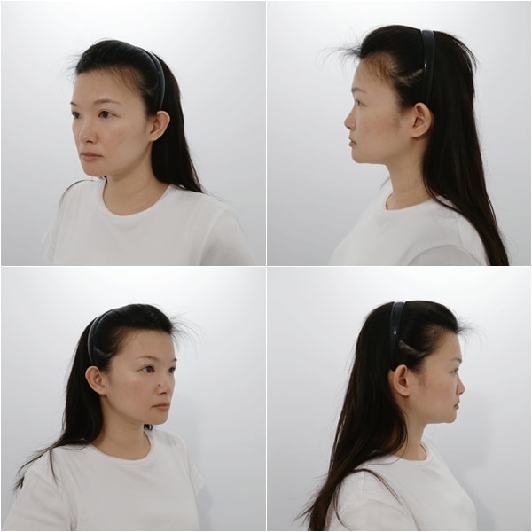 媚必提 佳思優醫美.jpg