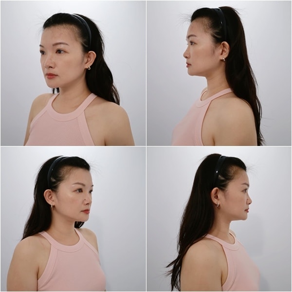 媚必提 佳思優醫美.jpg