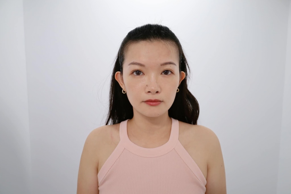 媚必提 佳思優醫美.jpg