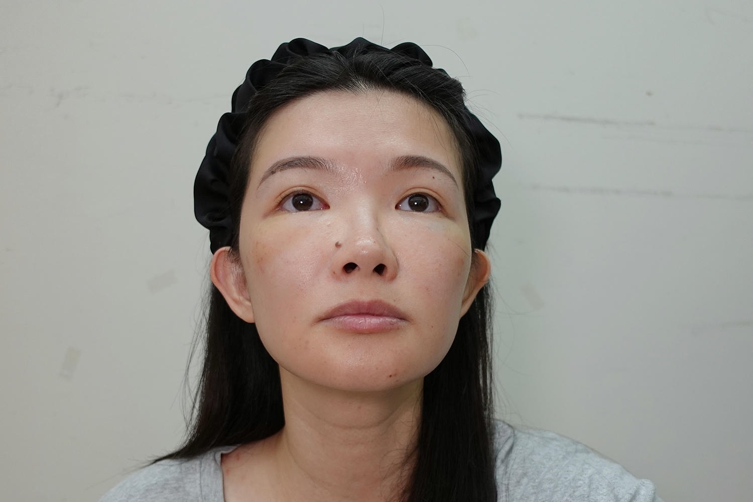 林上立醫師 薇貝拉 膠原蛋白