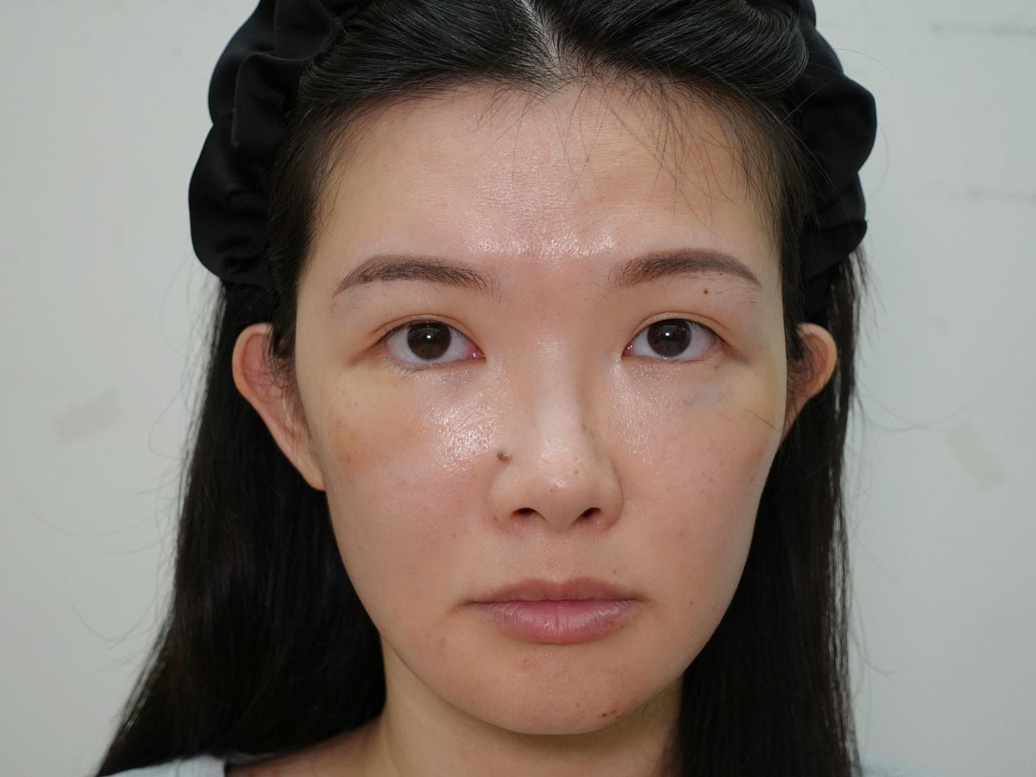 林上立醫師 薇貝拉 膠原蛋白