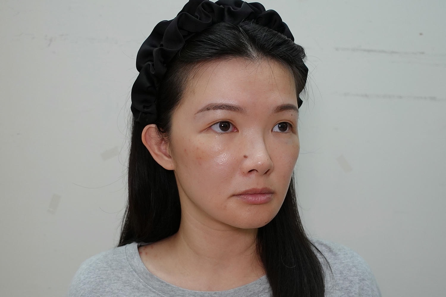 林上立醫師 薇貝拉 膠原蛋白