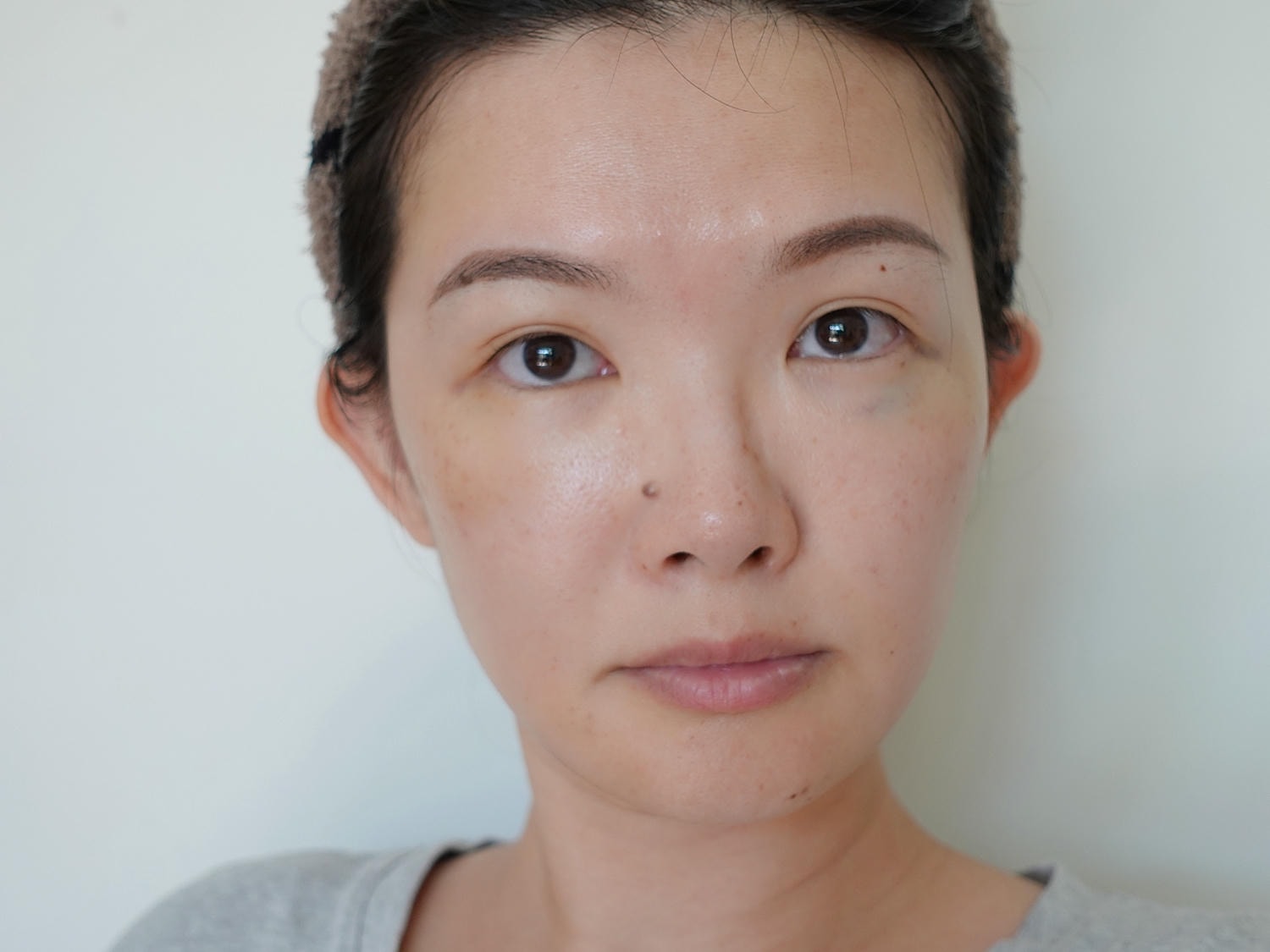 林上立醫師 薇貝拉 膠原蛋白