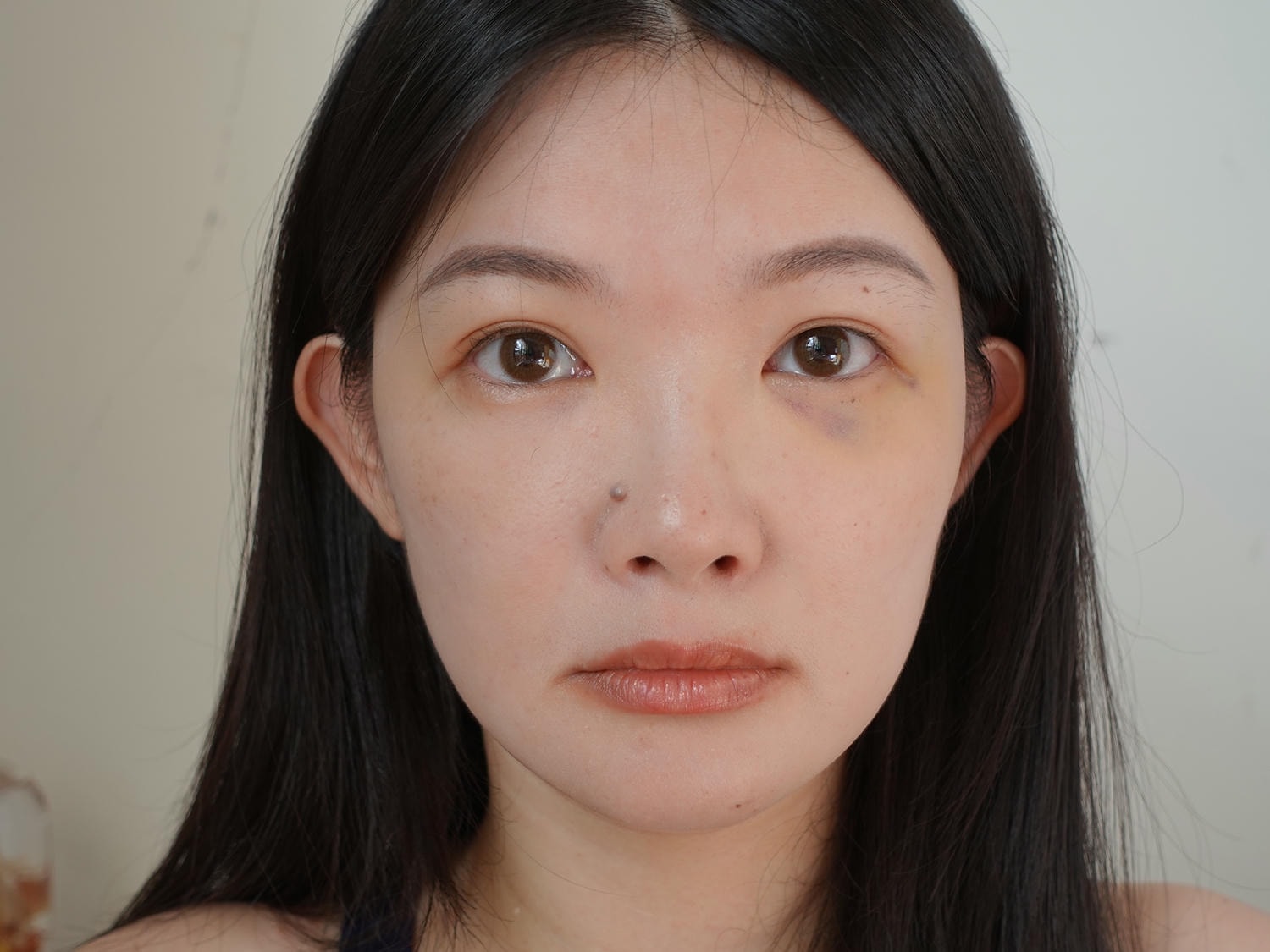 林上立醫師 薇貝拉 膠原蛋白