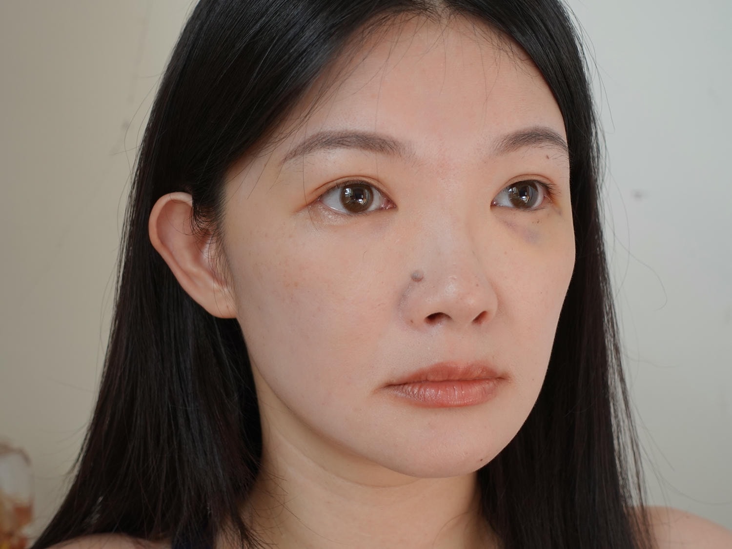 林上立醫師 薇貝拉 膠原蛋白